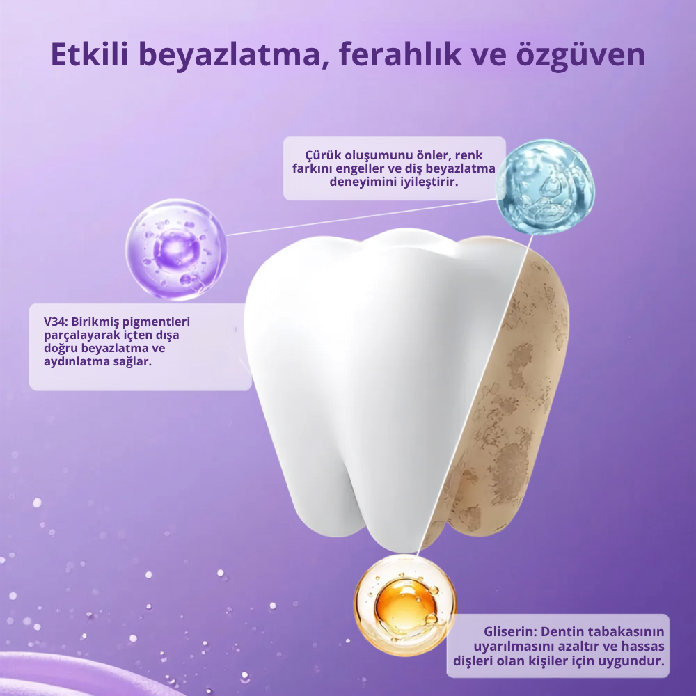 Violura V34 Mor Diş Beyazlatma Bandı